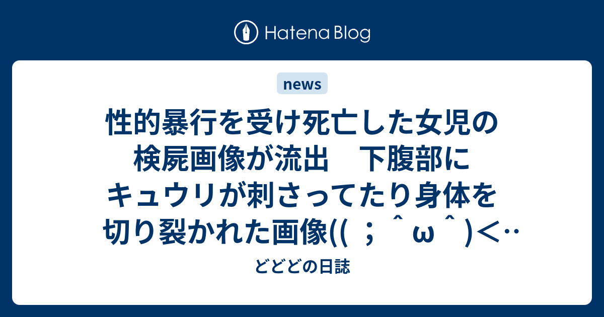 性的暴行を受け死亡した女児の検屍画像が流出 下腹部にキュウリが刺さってたり身体を切り裂かれた画像 W へいわぼけ どどどの日誌